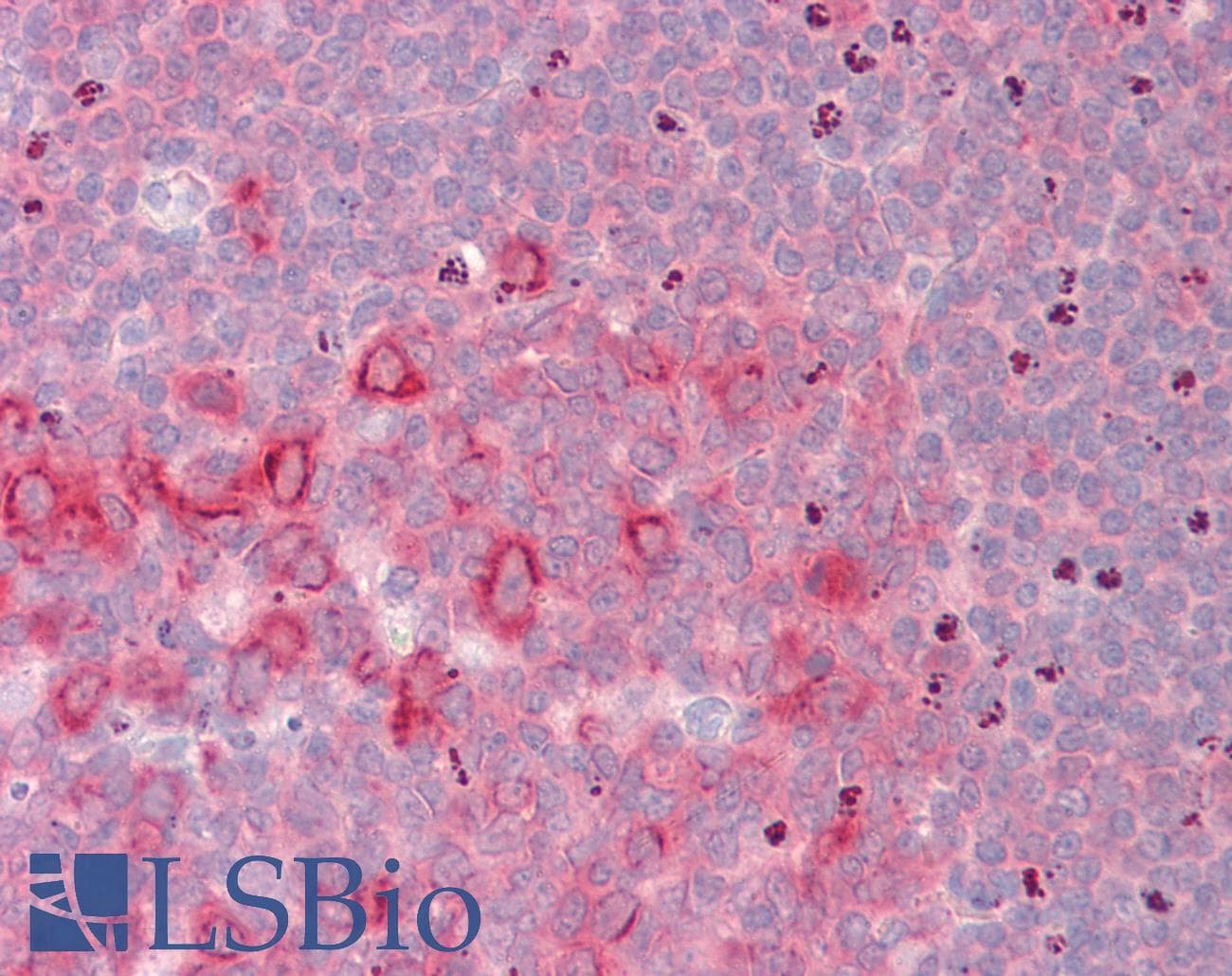 IHC-plus™ EEF2 / Elongation Factor 2 Antibody (clone 5B6)
