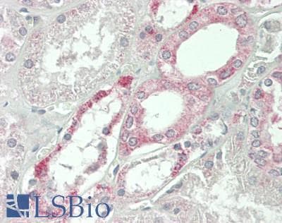 JAG1 / Jagged 1 Antibody (aa836-1047)