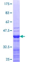 Human SP140 Protein (Recombinant GST, N-terminus)