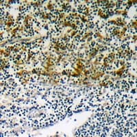 NCF1 / p47phox / p47 phox Antibody (C-Terminus)