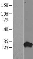 PROP1 Protein (Over-Expression Lysate Myc-DDK (Flag))