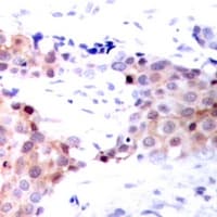NACA Antibody (phospho-S43)