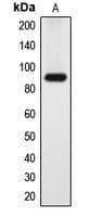 Polyclonal Rabbit anti-Human DYRK / DYRK1A Antibody (N-Terminus, IHC, IF, WB)