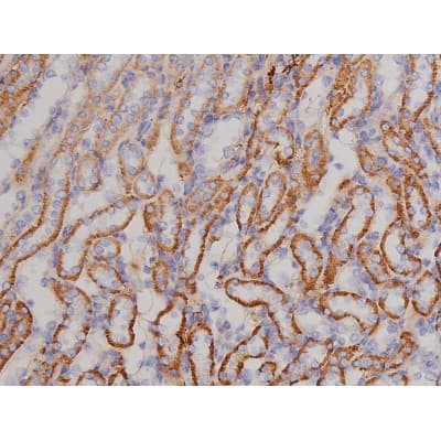 Polyclonal Rabbit anti-Human BCL2L1 / BCL-XL Antibody (phospho-Thr47, IHC, IF, WB)