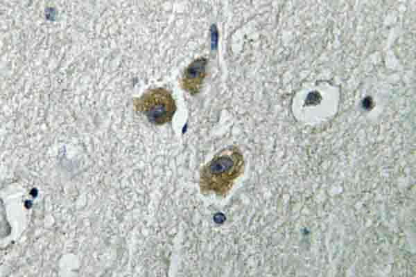 ME3 Antibody (Arg576)