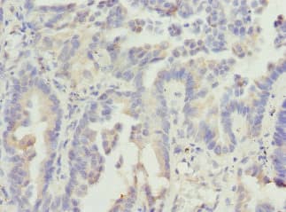 VANGL2 / LTAP Antibody