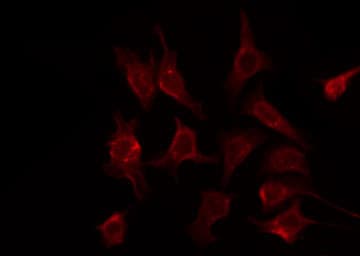 Polyclonal Rabbit anti-Human CREB3L2 / BBF2H7 Antibody (IF, WB)