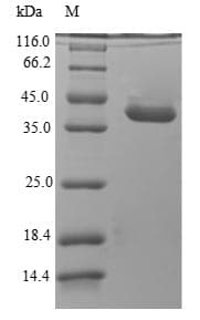 Dog Trypsin Protein (Recombinant 6His-SUMO, N-terminus)