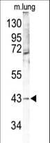 MAPK12 / ERK6 / SAPK3 Antibody (aa339-367)