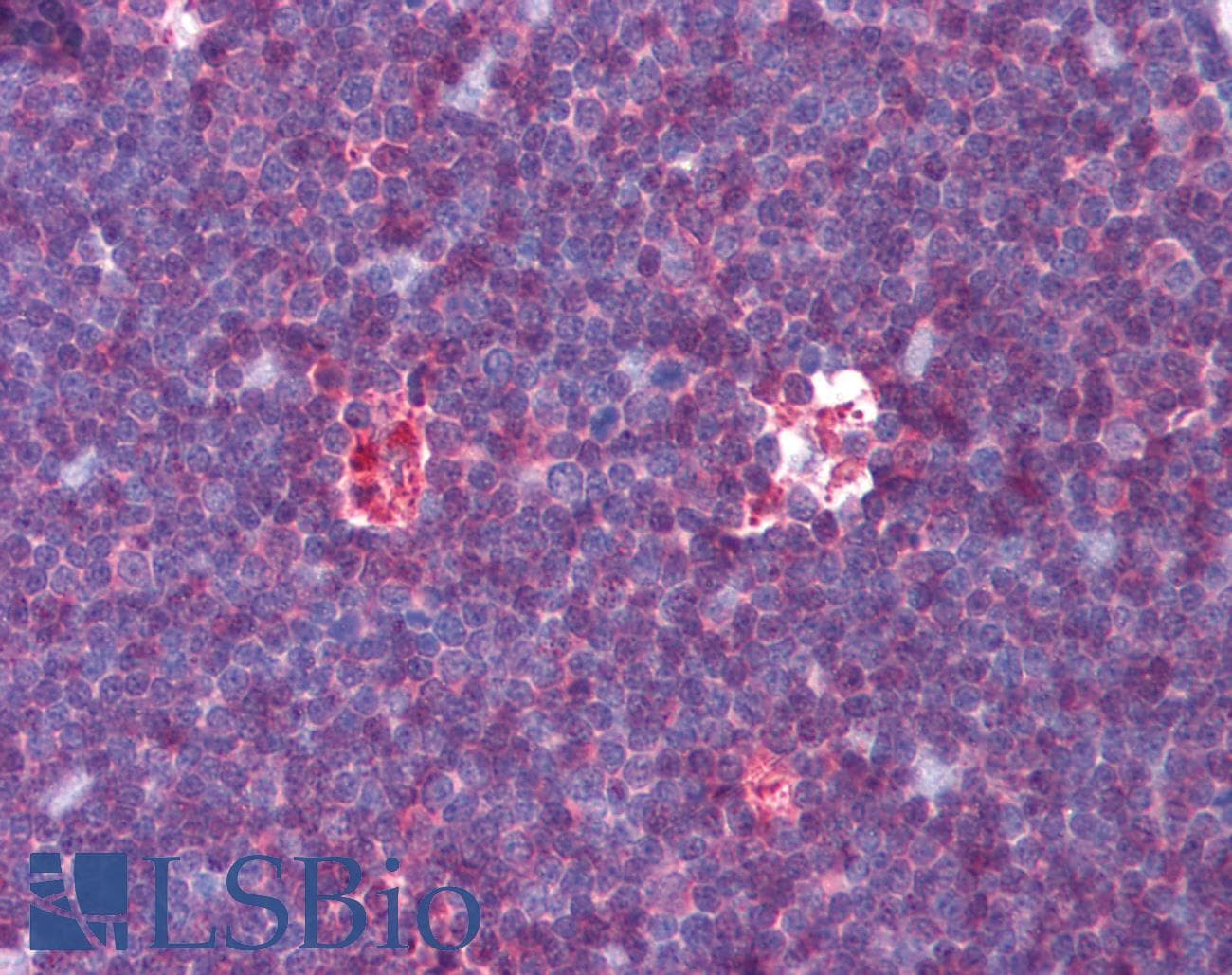 IHC-plus™ Polyclonal Rabbit anti-Human ADA / Adenosine Deaminase Antibody (aa335-353, IHC)