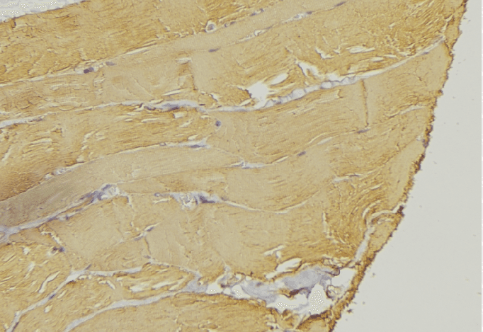 IARS2 Antibody