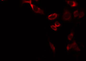 ATP5L2 Antibody
