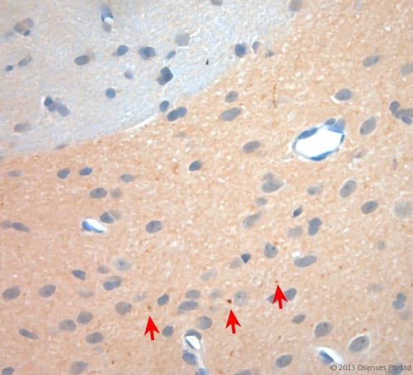 NGF Antibody (aa130-180)