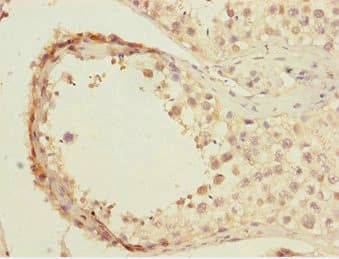 BTEB / KLF9 Antibody