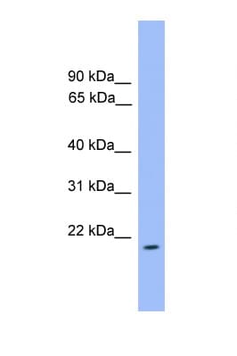 Polyclonal Rabbit anti-Human ARFL3 / ARL3 Antibody (aa71-120, WB)
