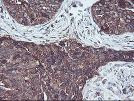 SH2D2A Antibody (clone OTI4F3)