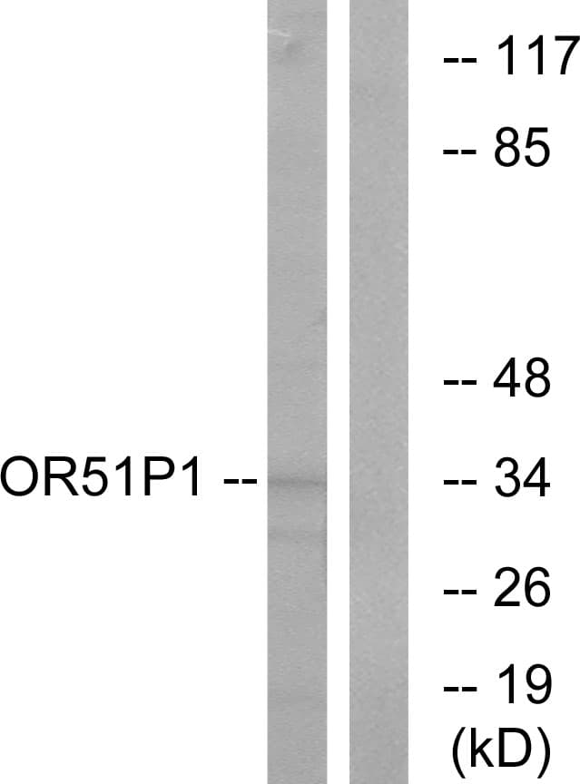 OR51D1 Antibody (aa33-82)