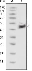 Monoclonal Mouse anti-Human TP53 / p53 Antibody (clone 4A8, IHC, WB)