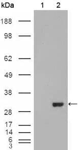 IHC-plus™ Monoclonal Mouse anti-Human CA1 / Carbonic Anhydrase I Antibody (clone 9D6D7, IHC, WB)