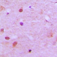 RCC2 Antibody (C-Terminus)