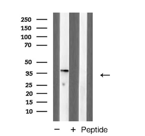 Polyclonal Rabbit anti-Human DUSP1 / MKP1 Antibody (IHC, IF, WB)
