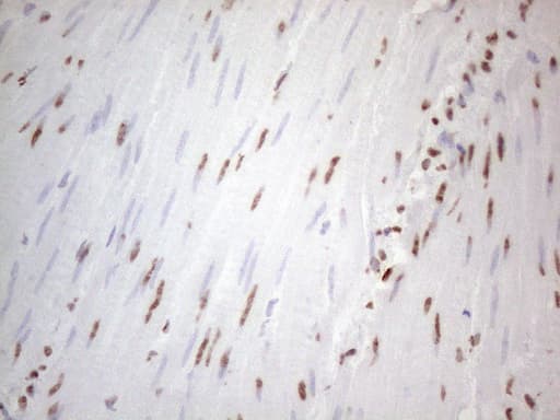 Monoclonal Mouse anti-Human HNRNPL / hnRNP L Antibody (clone OTI4E5, aa270-502, IHC)