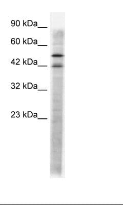 HTR3A / 5-HT3A Receptor Antibody (N-Terminus)