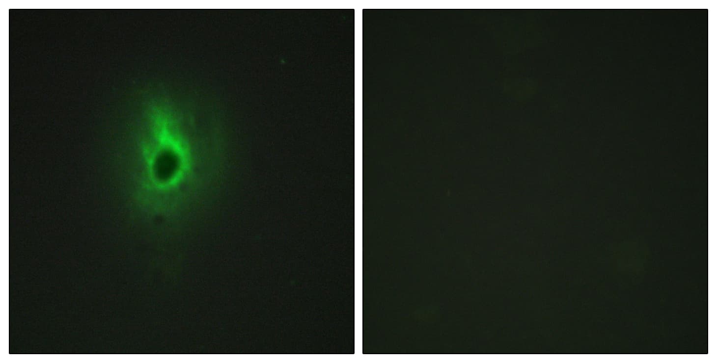 Polyclonal Rabbit anti-Human COL6A3 / Collagen VI Alpha 3 Antibody (aa2261-2310, IHC, IF)
