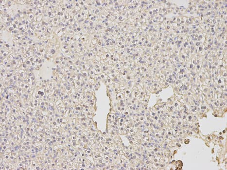 PDE1B Antibody
