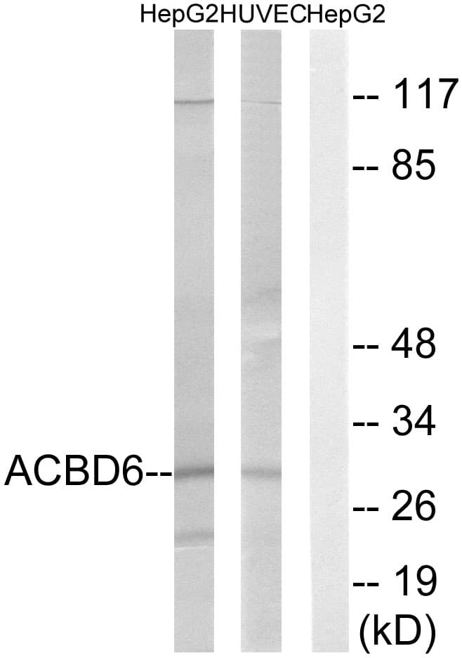 Polyclonal Rabbit anti-Human ACBD6 Antibody (aa121-170, WB)