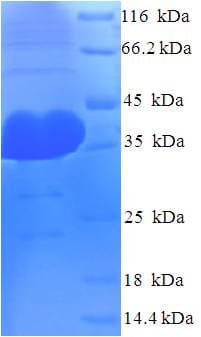 Human AGO2 / EIF2C2 Protein (Recombinant His)