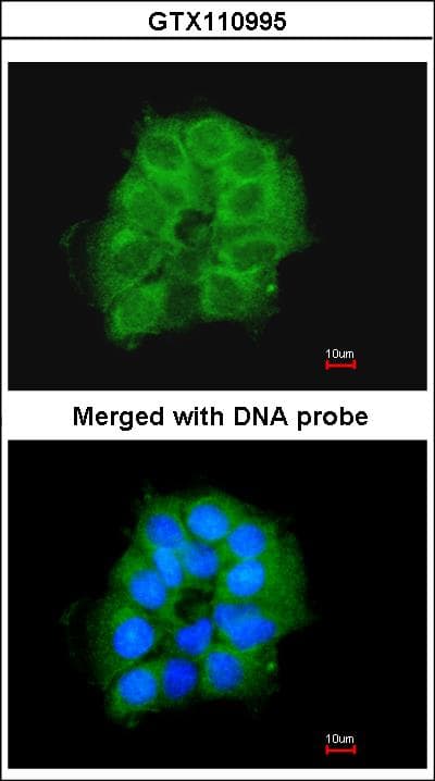 COX7B2 Antibody (aa1-81)