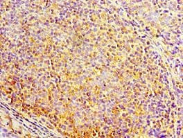 Polyclonal Rabbit anti-Human MAP2K3 / MEK3 / MKK3 Antibody (aa1-170, IHC)