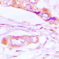 ERK1 + ERK2 Antibody (phospho-Thr202/Tyr204)