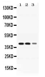 Polyclonal Rabbit anti-Human ADH4 Antibody (WB)