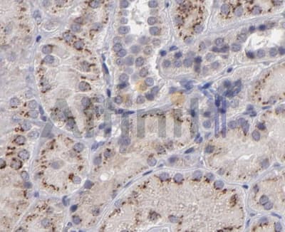 Polyclonal Rabbit anti-Human IL12A / p35 Antibody (IHC, WB)