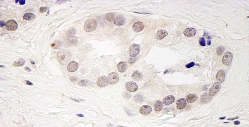 SMEK2 Antibody (aa715-C-term)