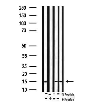 BIRC5 / Survivin Antibody (phospho-Thr117)