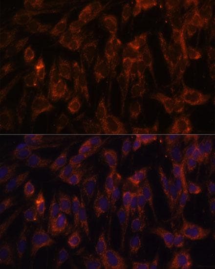 TLR3 Antibody