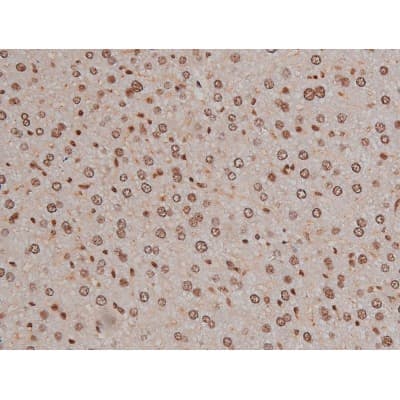 IGF1R / IGF1 Receptor Antibody (phospho-Tyr1346)
