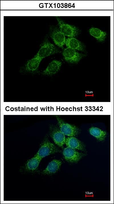 Polyclonal Rabbit anti-Human HSD17B4 Antibody (aa355-645, IHC, WB)