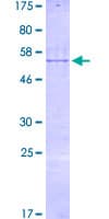 Human RBM40 / RNPC3 Protein (Recombinant GST)