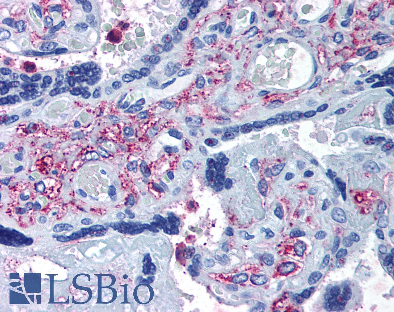 IHC-plus™ Polyclonal Rabbit anti-Human ADAMTS5 Antibody (Internal, IHC)