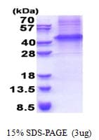 Human GFRA3 Protein (Recombinant His)