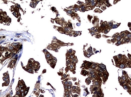 NME1 / NM23 Antibody (clone UMAB94)
