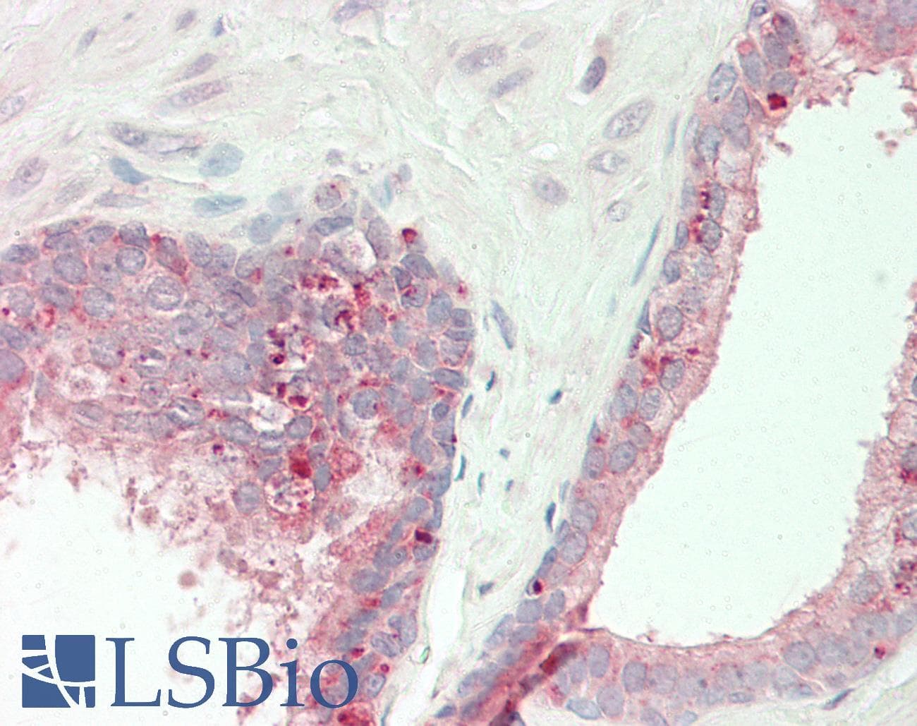 SLCO5A1 Antibody (aa431-480)