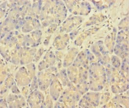 KCNMA1 / BK Antibody
