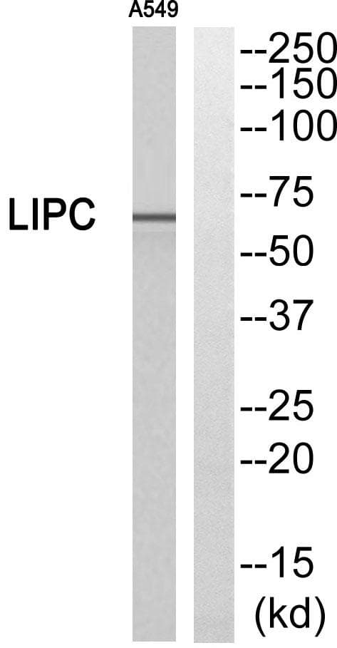 LIPC / Hepatic Lipase Antibody