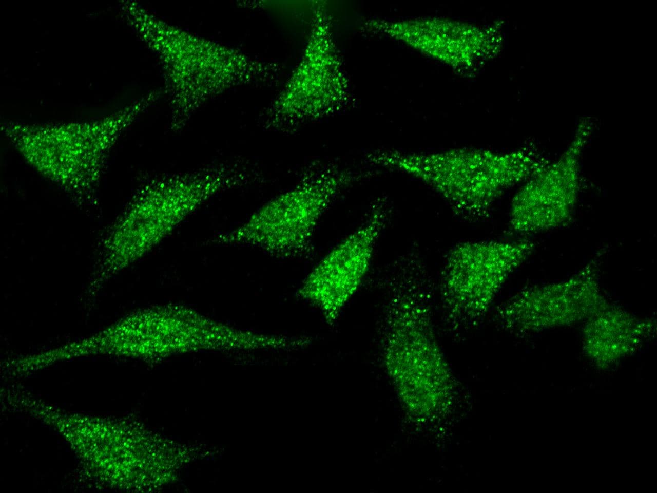 CHEK1 / CHK1 Antibody (Preservative Free)