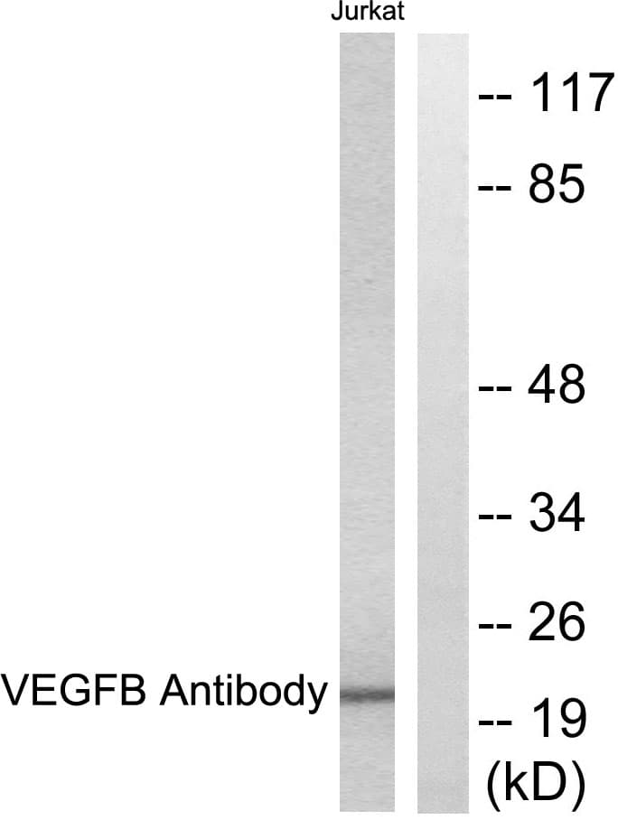 VEGFB Antibody